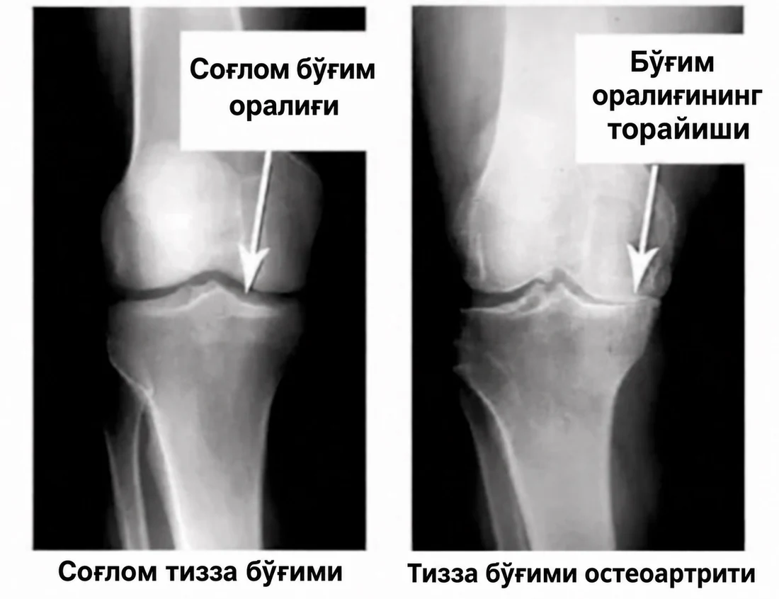 Бўғимлар тасвири